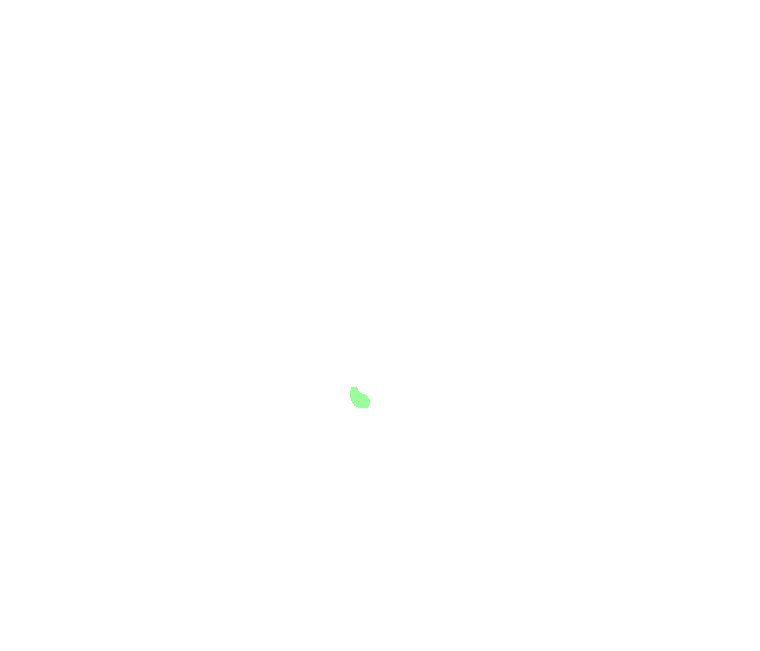 External auditory meatus