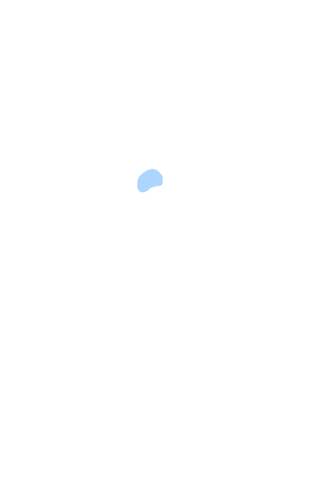 Foramen rotundum