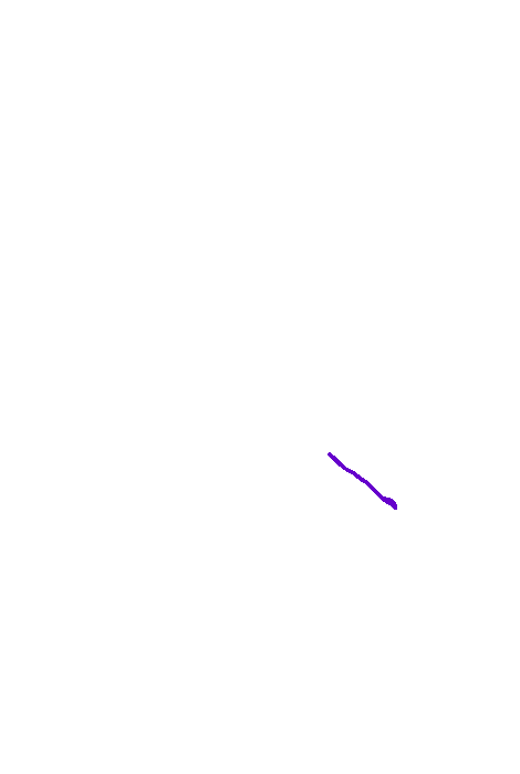 Hiatus & groove for greater petrosal nerve