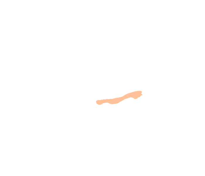 Zygomatic process of temporal bone