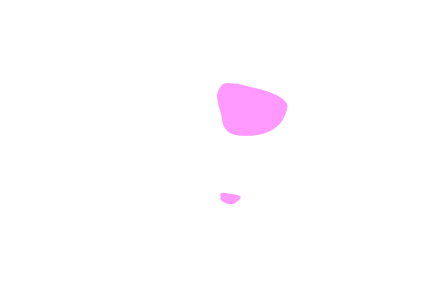 Rectus Capitis Minor