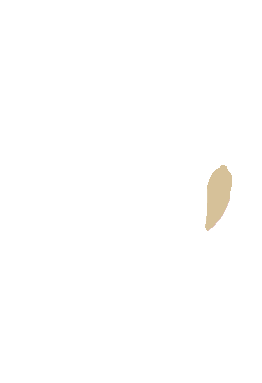 Orbital fossa for lacrimal sac