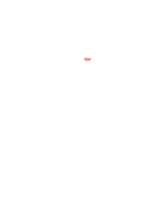 Orbital supraorbital foramen