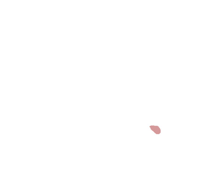 Hypoglossal canal