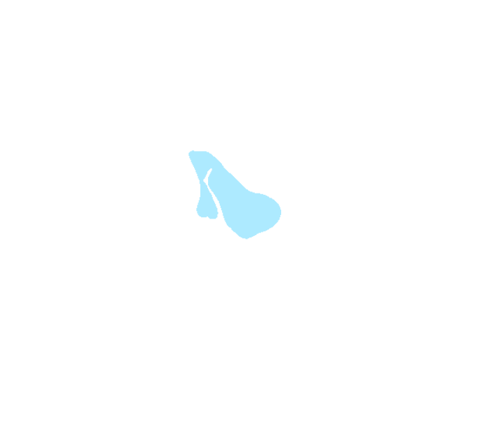 Sphenoid sinus