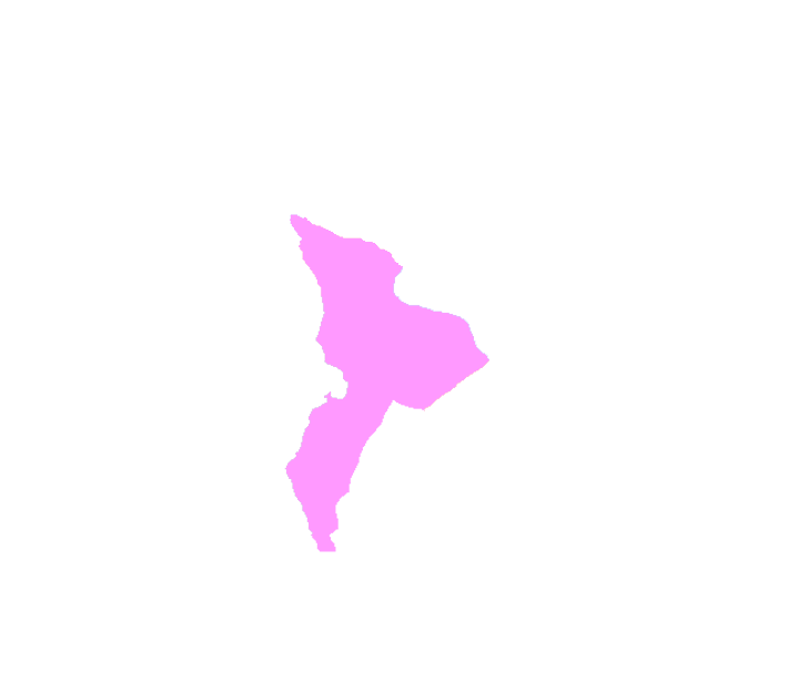 Sphenoid bone