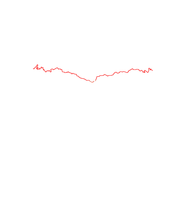 Coronal suture