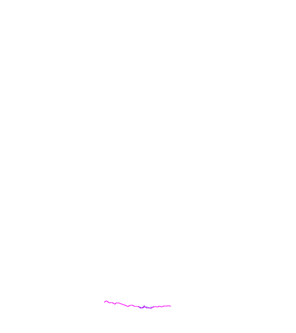 Lambdoid suture