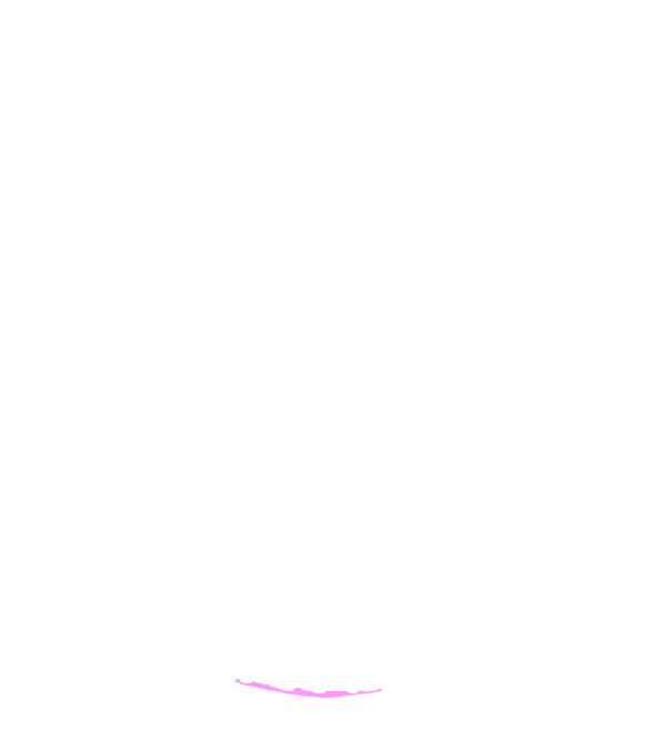 Occipital bone