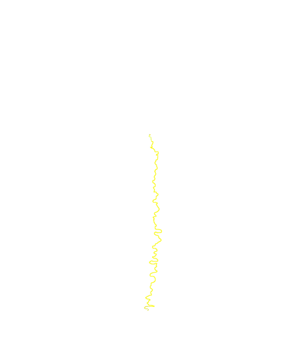 Sagittal suture