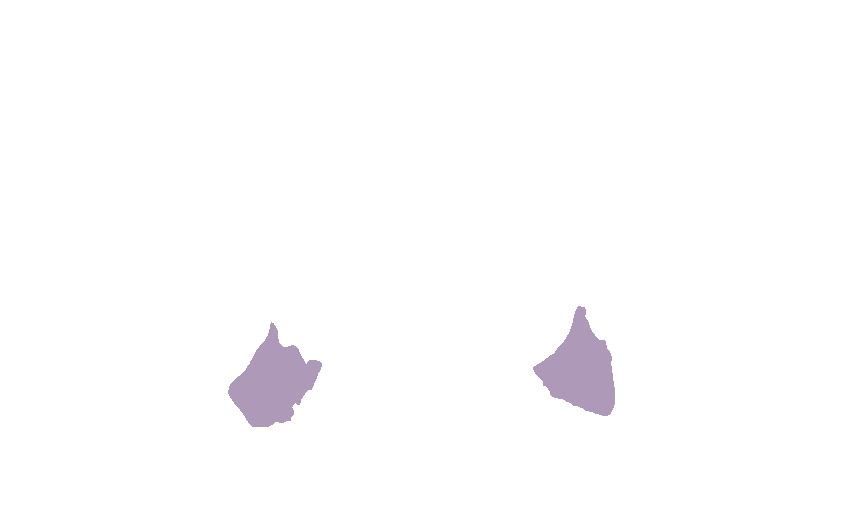 Lateral Pterygoid Plates