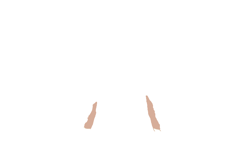 Medial Pterygoid Plates