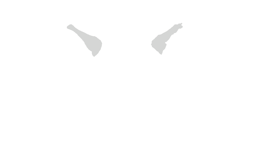 Superior Orbital Fissures
