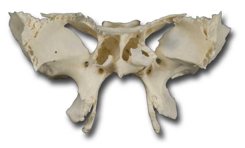 Sphenoid Bone