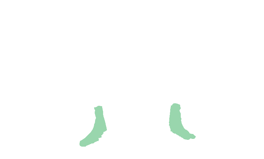 Lateral Pterygoid Plates