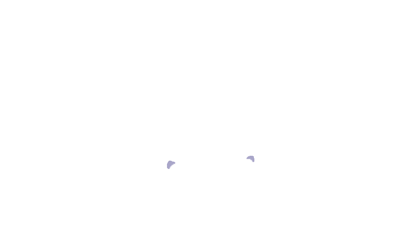 Pterygoid Fossae