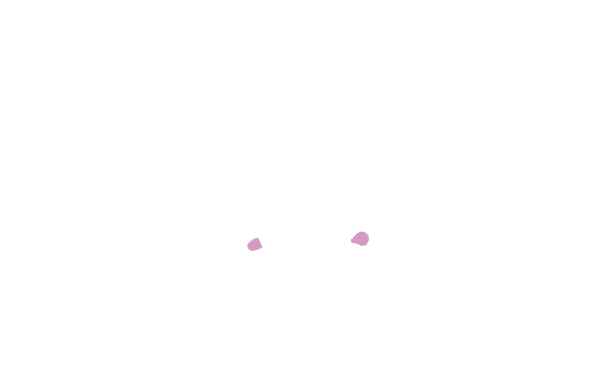 Pterygoid Tubercles