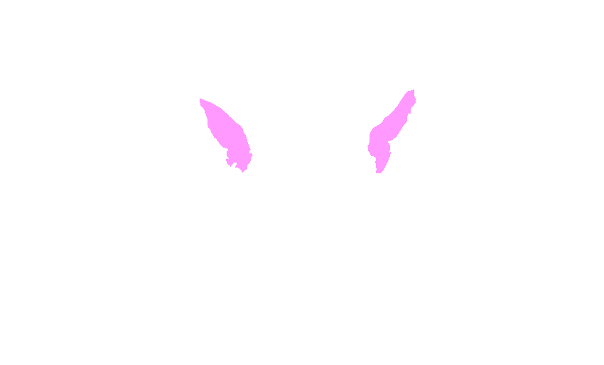 Superior Orbital Fissures