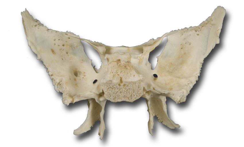 Posteroinferior View