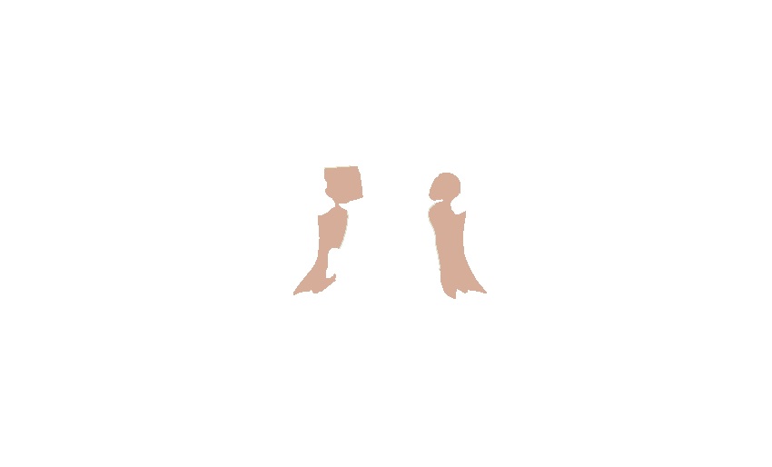 Carotid Sulci