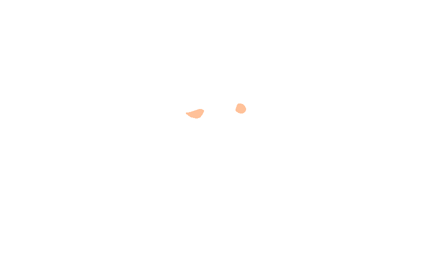 Middle Clinoid Processes