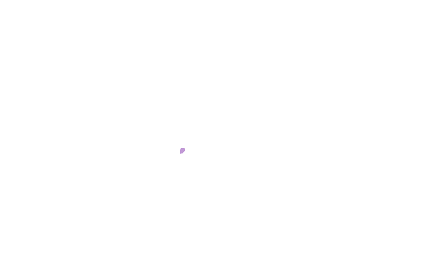 Posterior Clinoid Processes