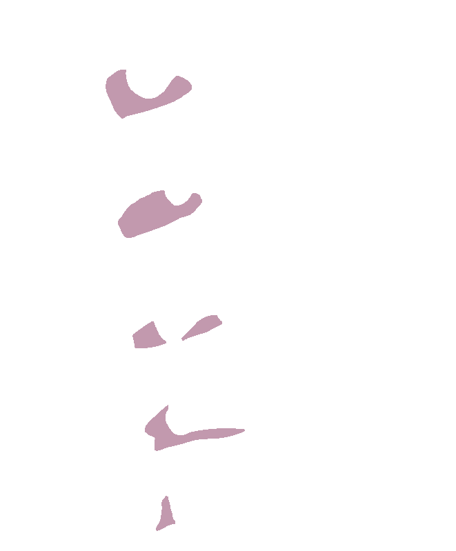 Spine cervical superior articular processes