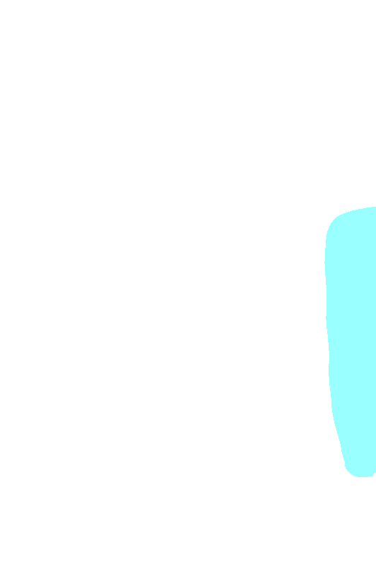 Infraspinatus