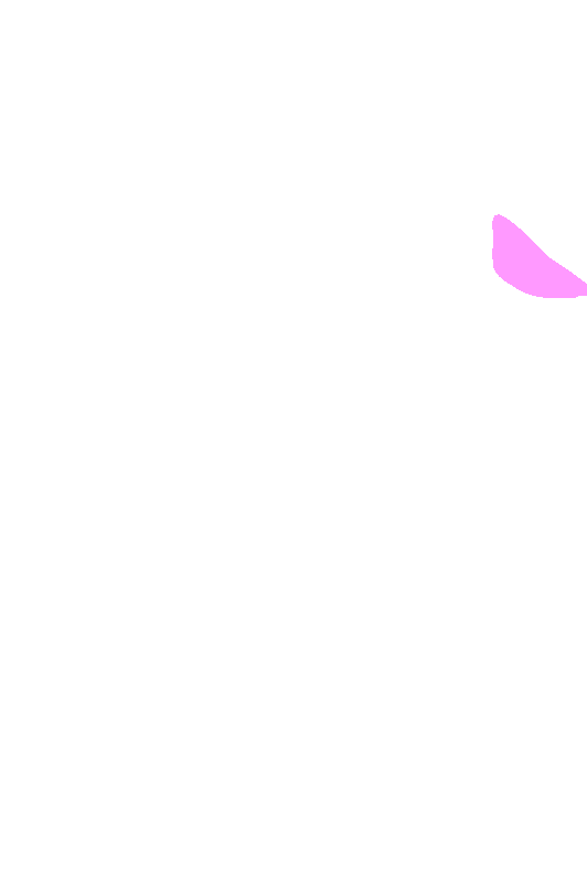 Supraspinatus