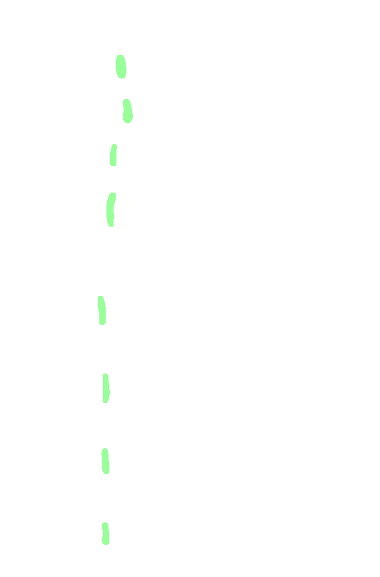 Trapezius