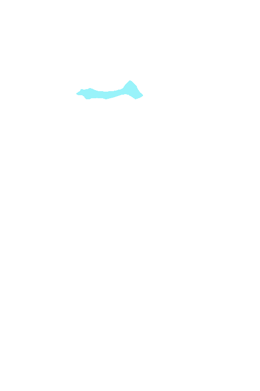 Anterior cerebral