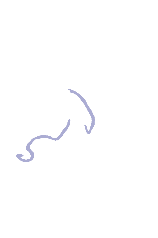 Anterior inferior cerebellar