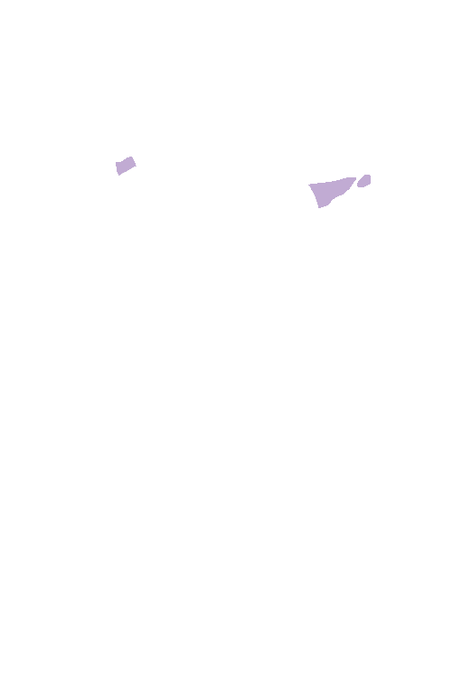 Middle cerebral