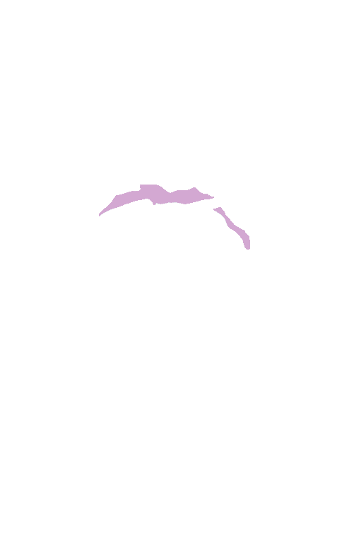 Posterior cerebral