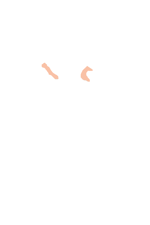 Posterior communicating