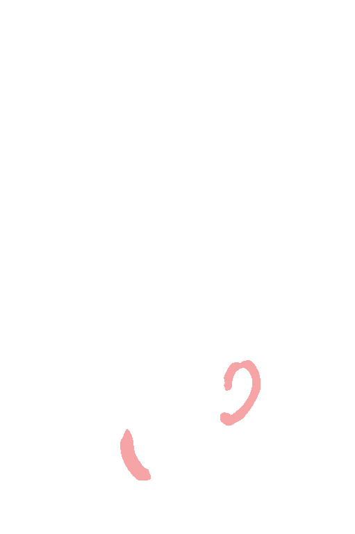 Posterior inferior celebellar