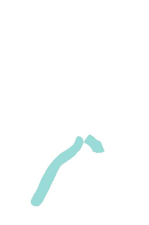 Vertebral