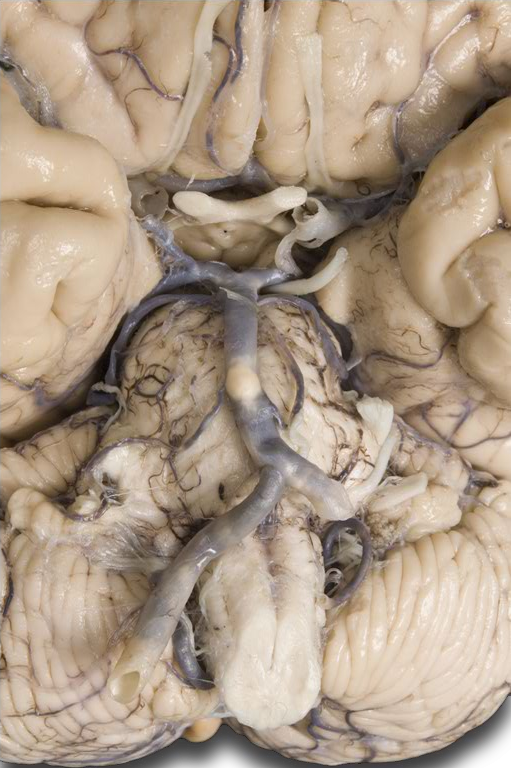 Ventral brain arteries