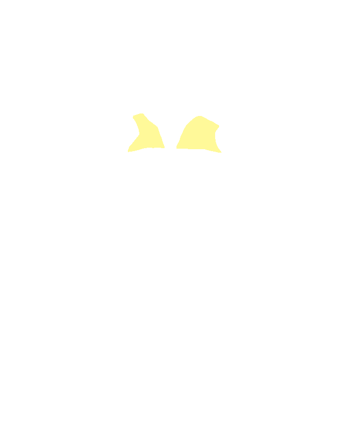 Cerebral peduncles