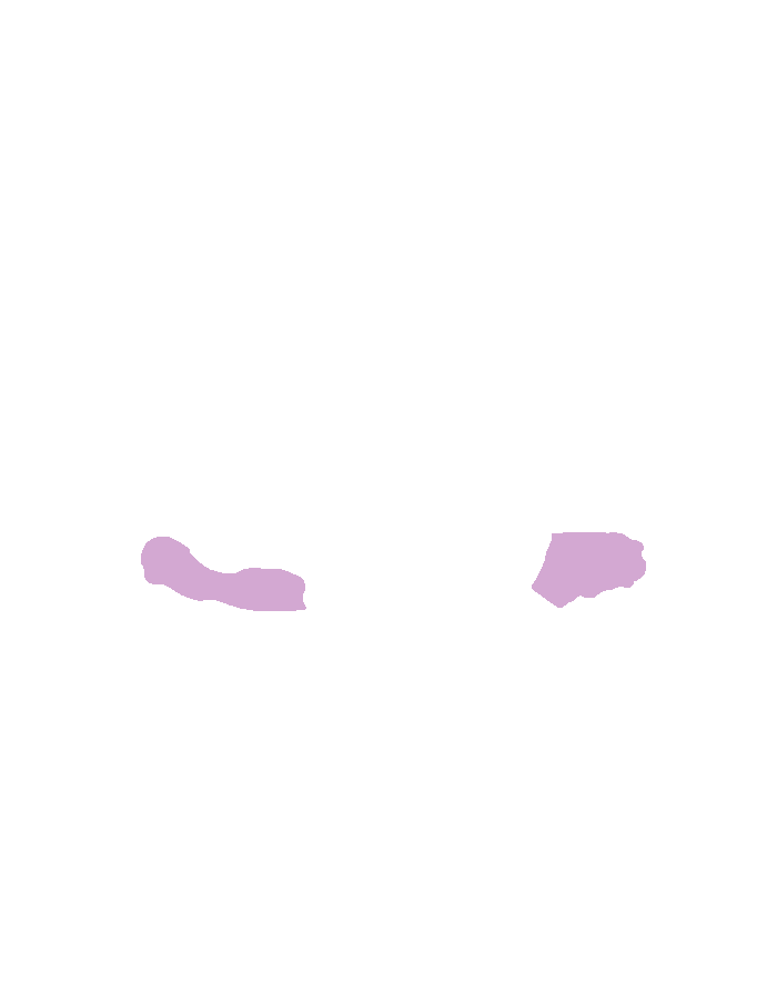 Flocculi