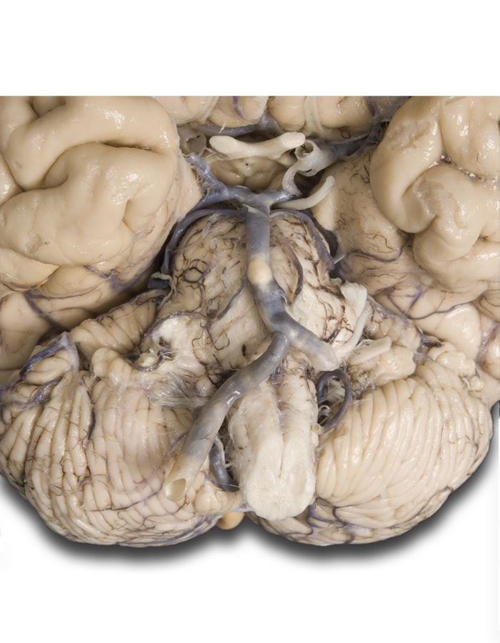 Ventral brain brainstem cerebellum