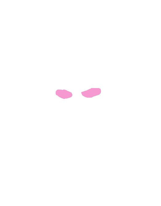 Optic nerves