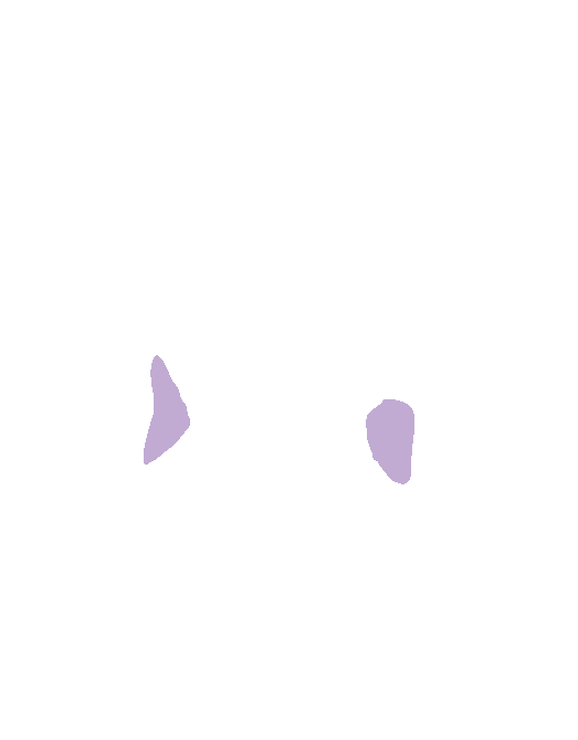 Unci