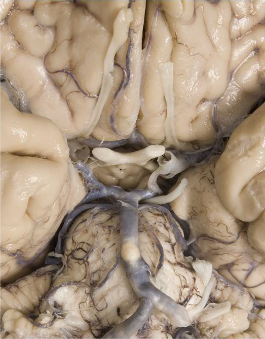 Ventral brain cerebrum