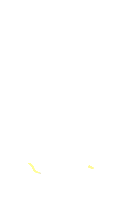Glossopharyngeal