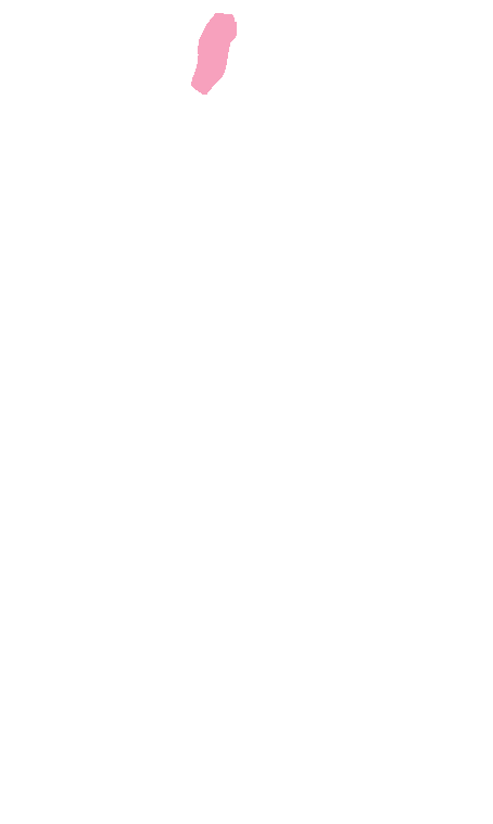 Olfactory bulb