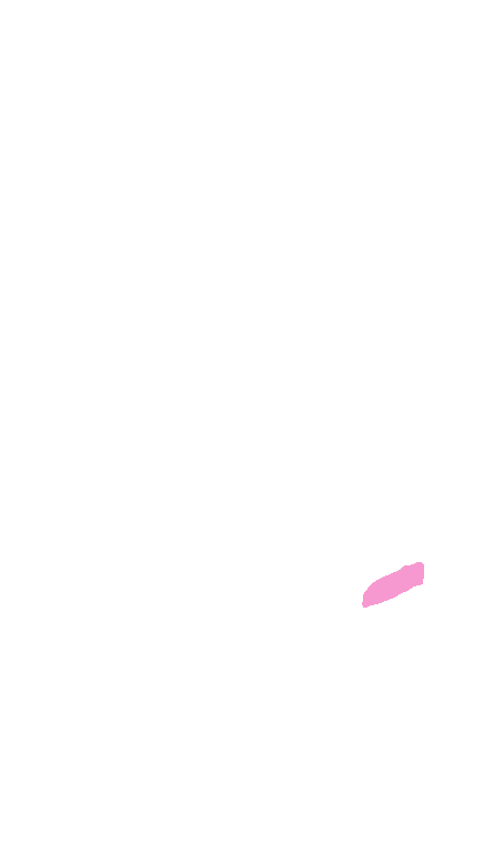 Vestibulocochlear