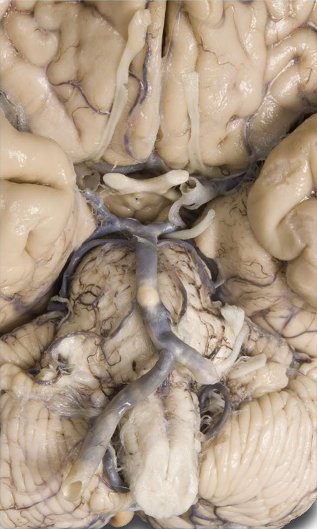 Ventral brain nerves