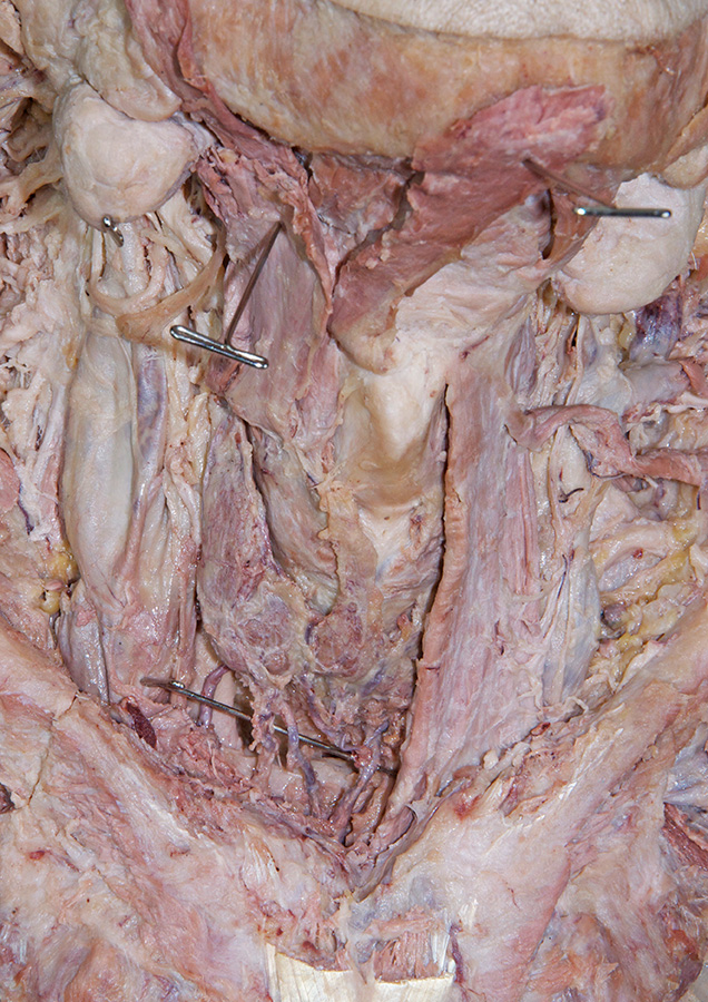 Inferior Thyroid Veins