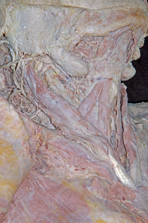 Infrahyoid Muscles